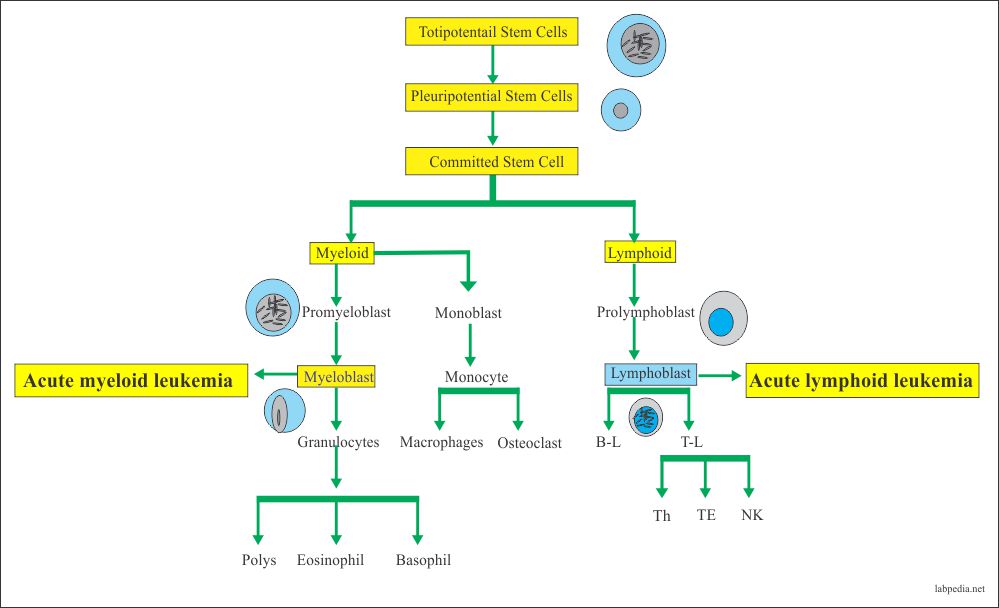 Acute Leukemias And Their Diagnosis Acute Myelocytic And Acute