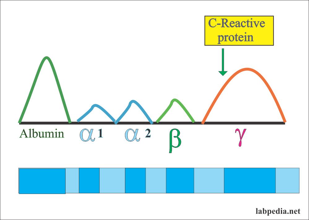 Acute Phase Protein Part 6 C Reactive Protein Crp High