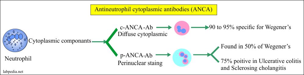 Antineutrophil cytoplasmic antibody (ANCA), Wegener’s Granulomatosis