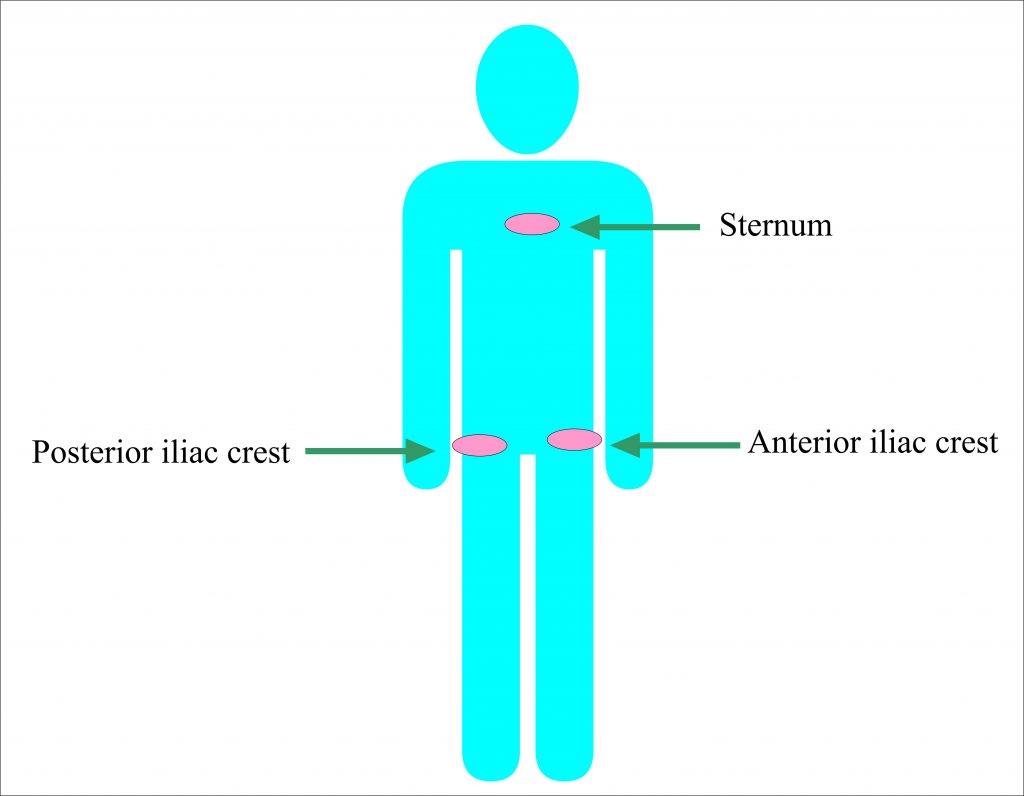 Bone Marrow Aspiration and Trephine Biopsy Part 1