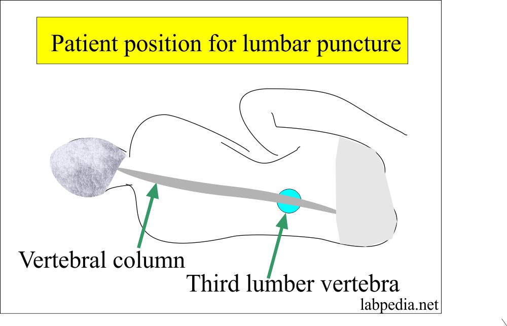Cerebrospinal Fluid Analysis Part 2 (CSF), Complete Examination