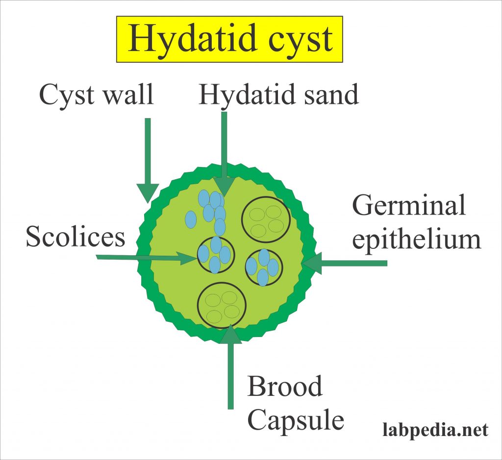 Echinococcus Granulosus, Hydatid Disease, Hydatid Cyst