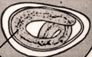 enterobius vermicularis vizelet