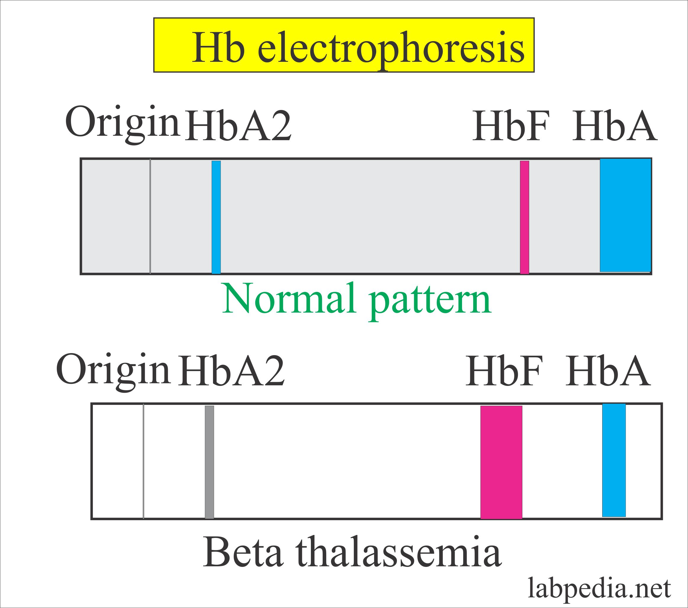 Fetal Hemoglobin (HbF, Alkali resistant Hemoglobin, Fetal HbF