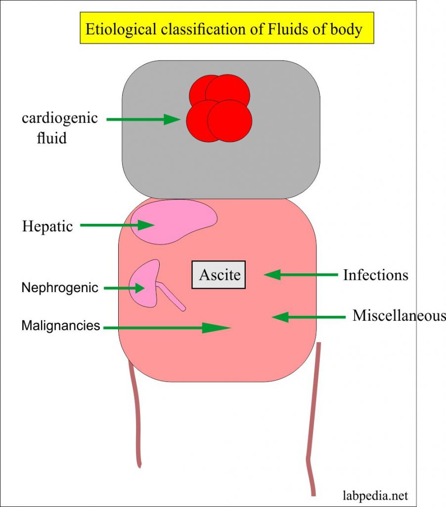 Fluid Analysis – Part 3 – Ascitic fluid Etiological Classification