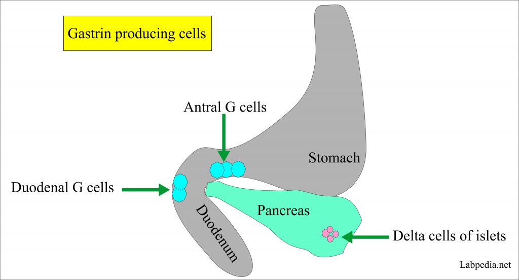 Gastrin Level, ZollingerEllison Syndrome
