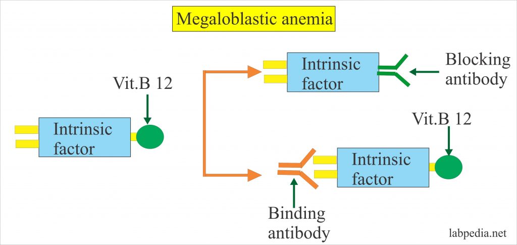 Intrinsic factor Antibody (IF Ab)