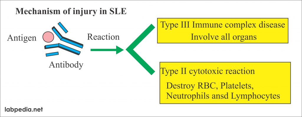 Mechanism of the Injury in the SLE