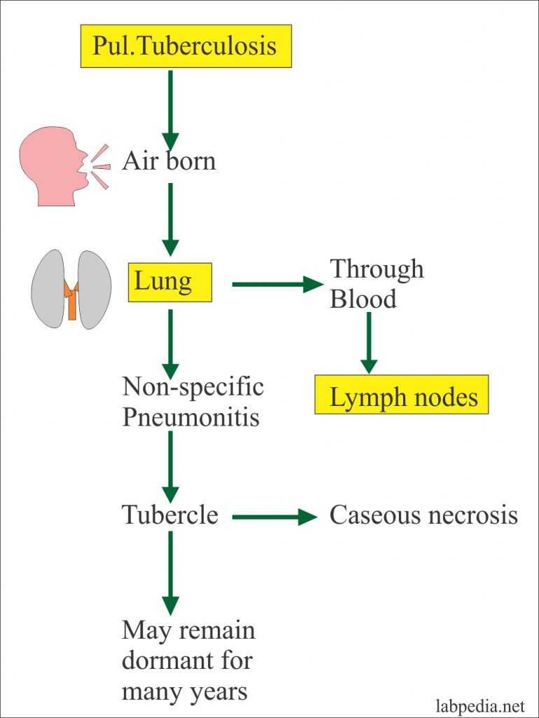 Mycobacterium Tuberculosis Spread Mycobacterium Tuberculosis Spread