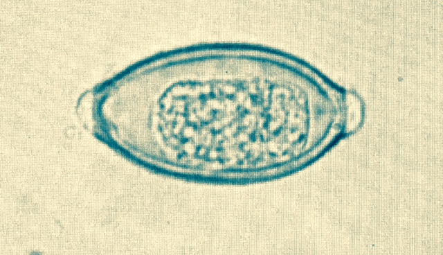 Common parasites: Trichuris Trichiura