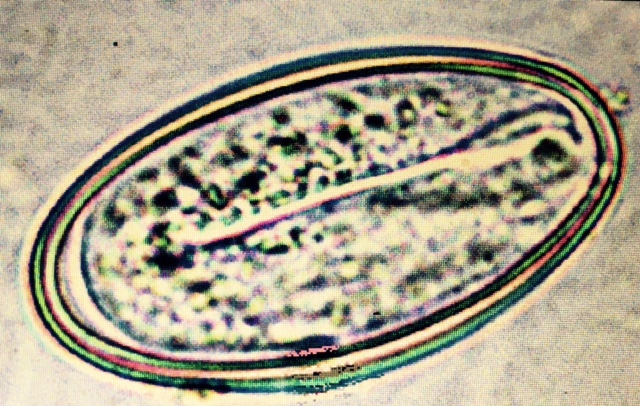 The Ovum with Embryo
