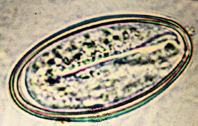 The Ovum with Embryo The Ovum with Embryo