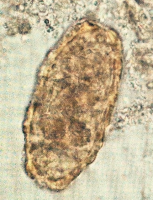 Unfertilized Ovum Unfertilized Ovum