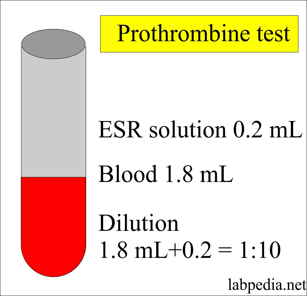 Prothrombin Test blood and ESR Solution ratio