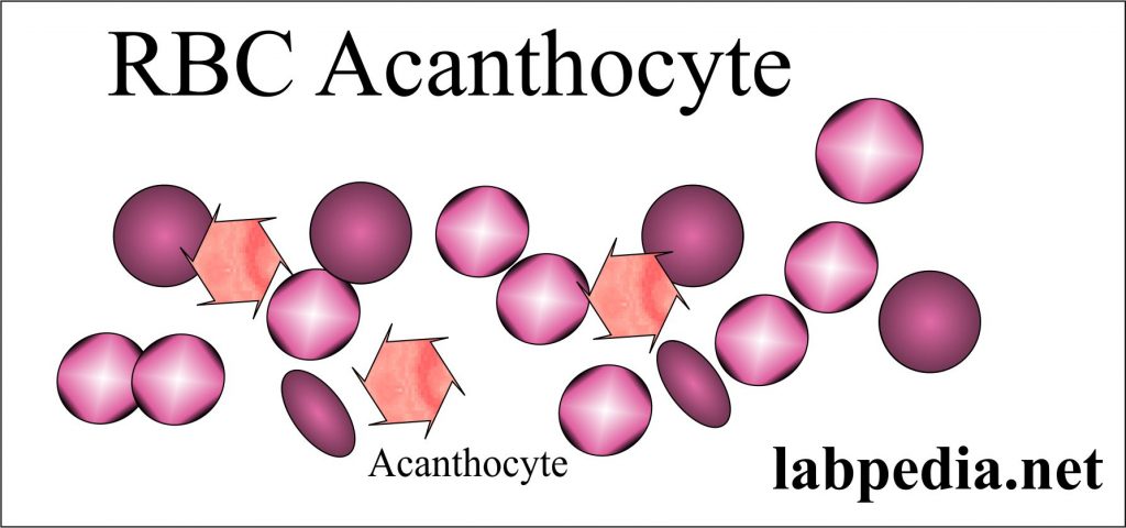 Acanthocytes Acanthocytes