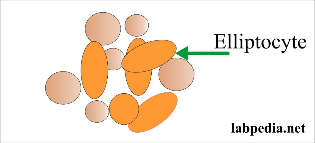 Ellipotocytes Ellipotocytes