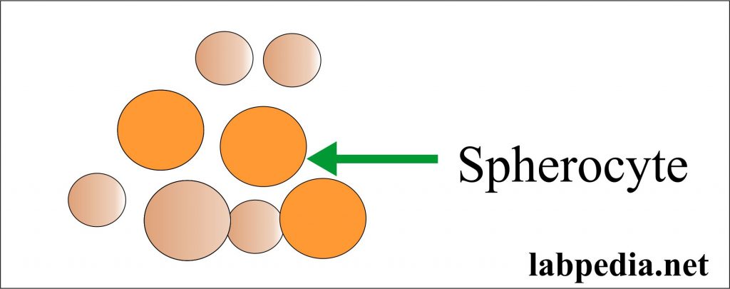 Spherocytes Spherocytes