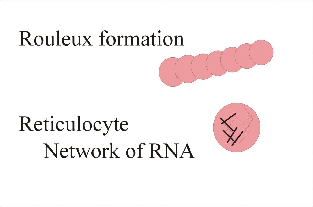 Red Blood Cell (RBC):- Part 2 – Peripheral blood smear, Normal Picture and RBC Morphology