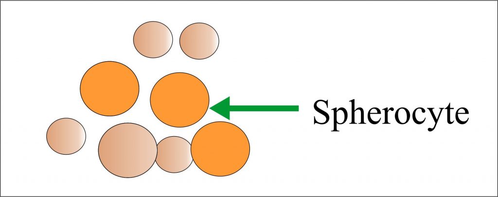 Spherocytes Spherocytes