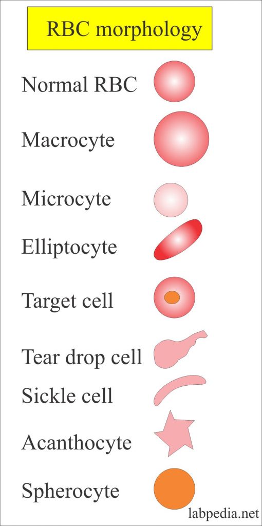 Red blood cells morphologically various shapes