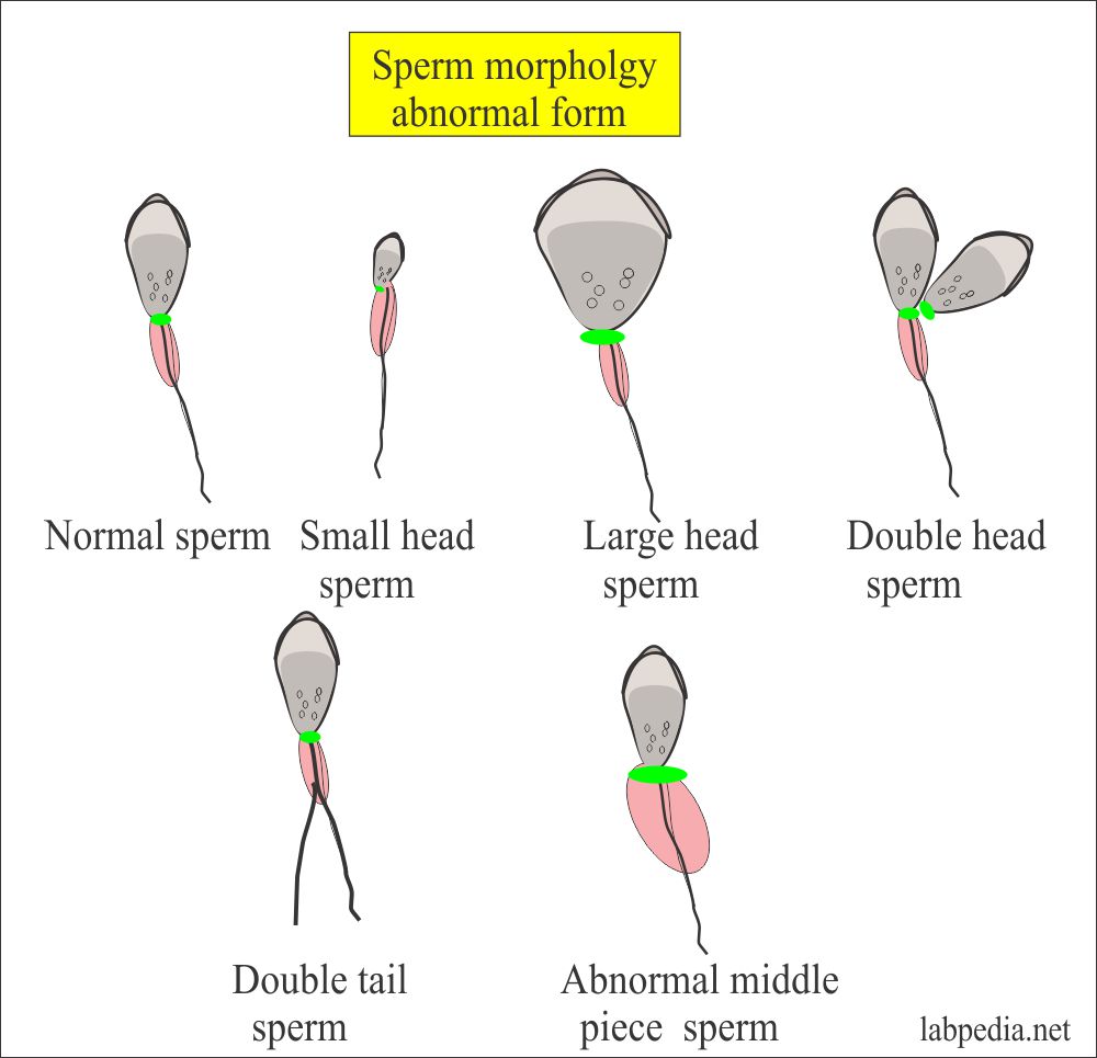 Semen Part 1 Semen Analysis Semen Examination And Counting Procedure