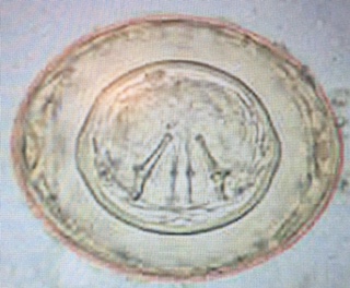   Hymenolepis Nana Egg showing hooklets