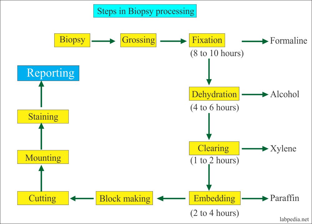 Steps in the processing of surgical biopsy