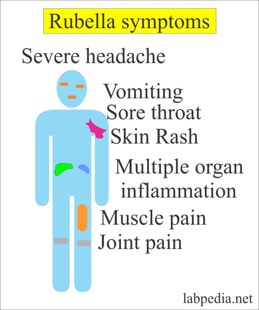 torch-profile-part-1-rubella-virus-labpedia