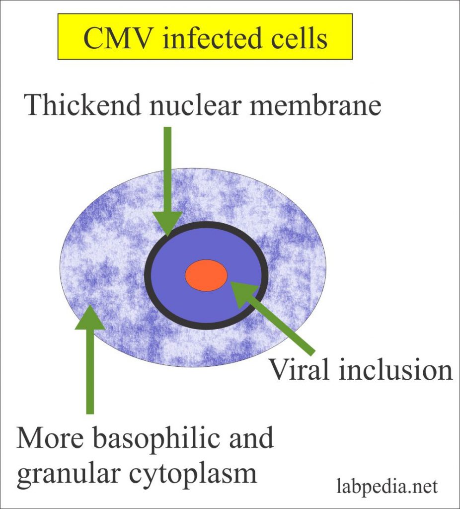 Presence of CMV in the infected cells Presence of CMV in the infected cells