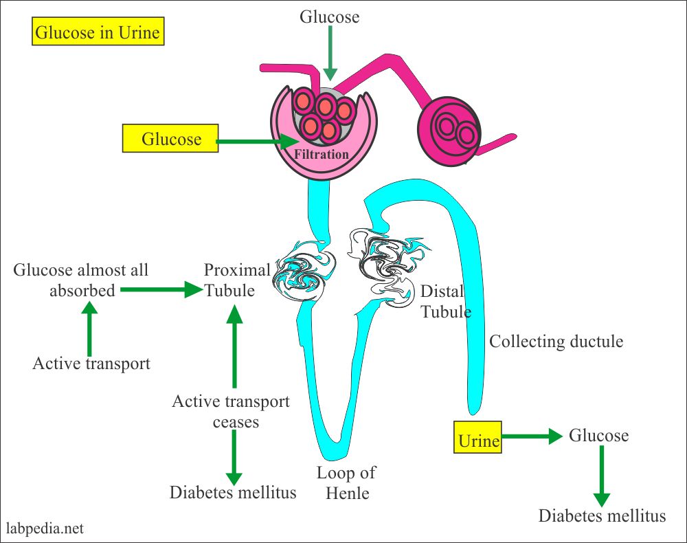 Presence of Glucose in the Urine Presence of Glucose in the Urine
