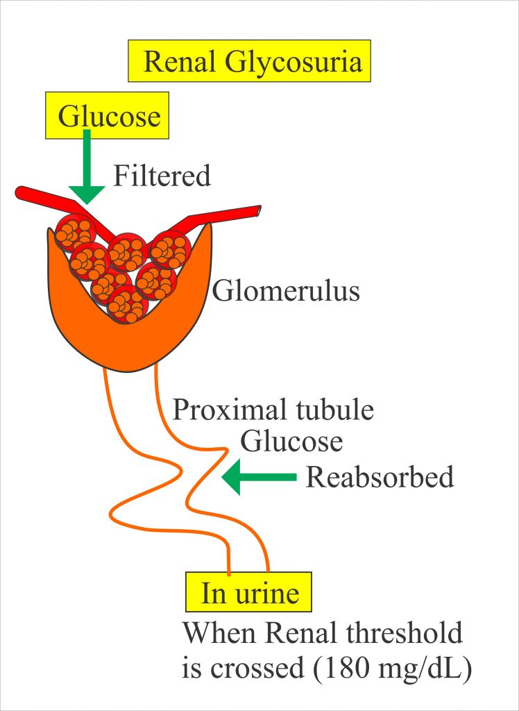 Presence of Glucose in the Urine Presence of Glucose in the Urine