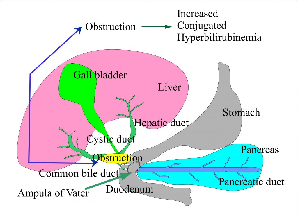 Urine Part 10 Bilirubin in Urine