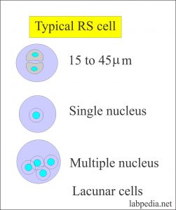 Reed sternberg cells