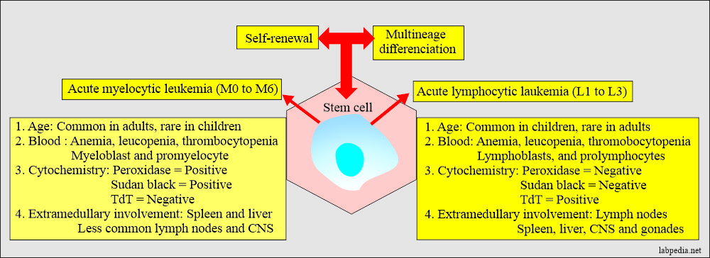 Acute leukemias: Acute leukemia development from the stem cells and clinical presentations