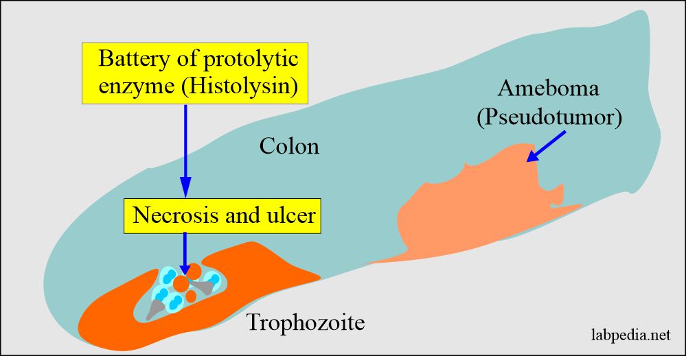 Pathogenesis of ulcer and ameboma