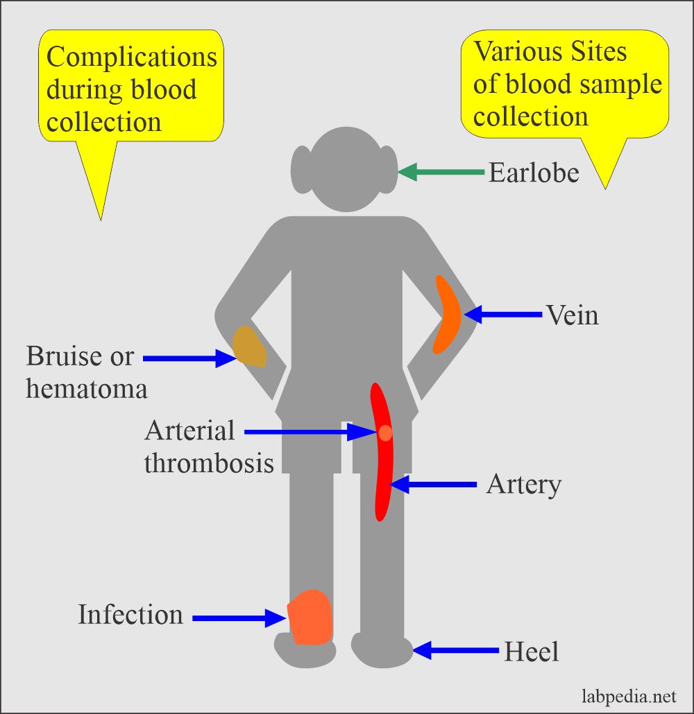 Blood collection site and complications