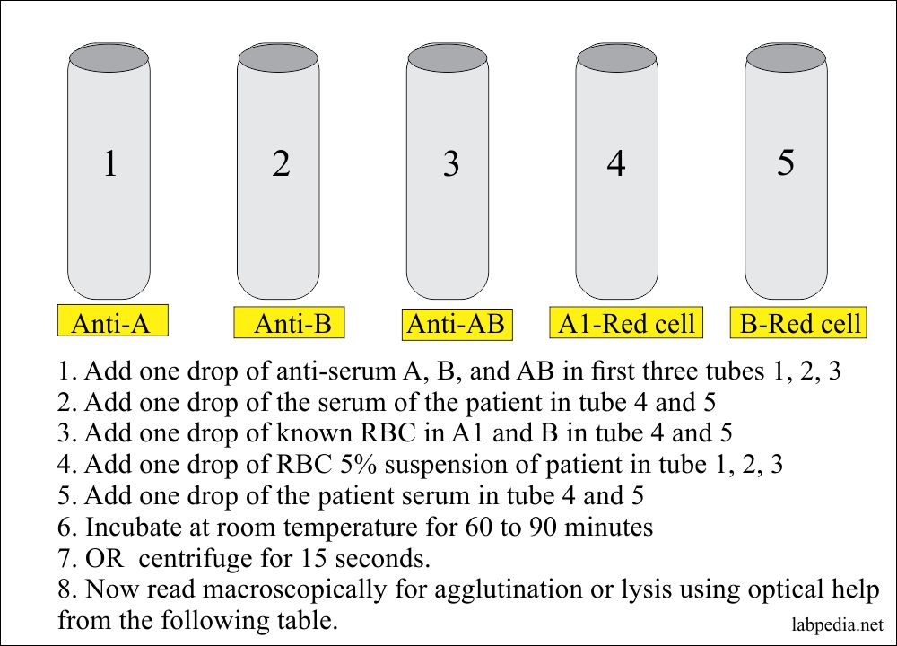 Blood Banking Part 1 Blood Grouping Blood Group Abo And Rh
