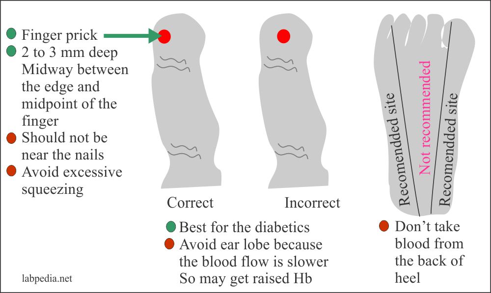 Capillary Blood Draw Procedure