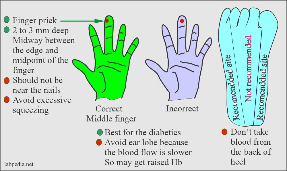 Various sites for the Capillary blood procedure