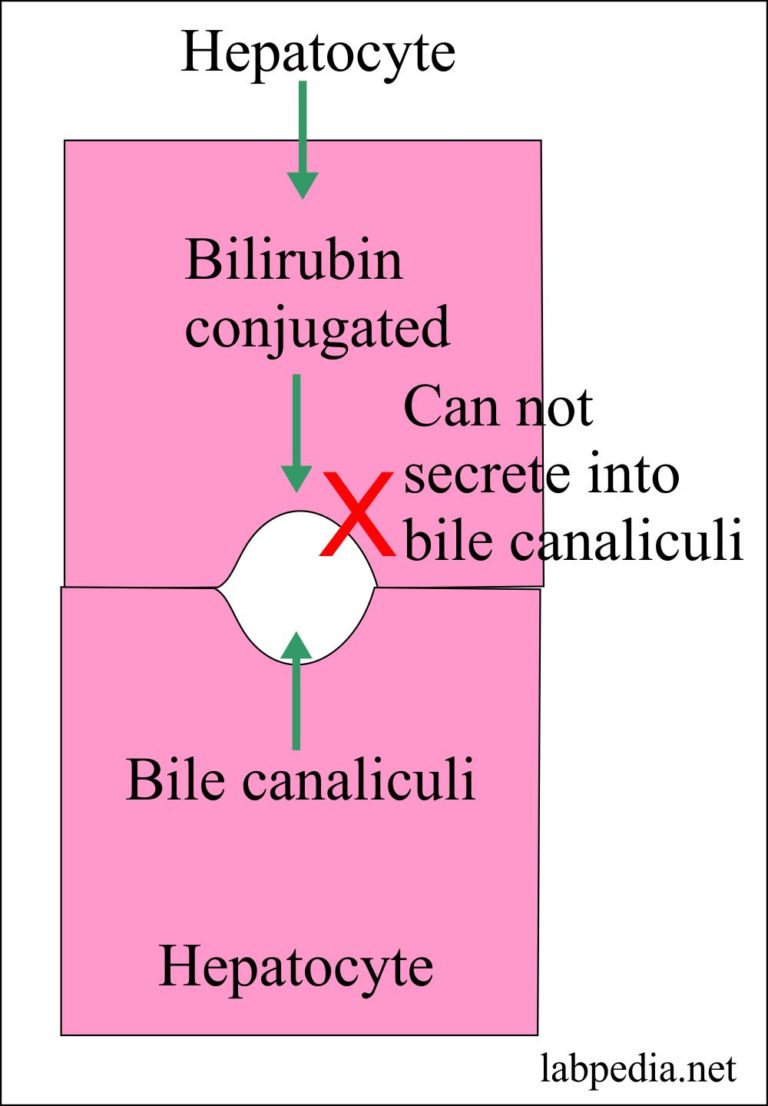 DubinJohnson Syndrome Diagnosis
