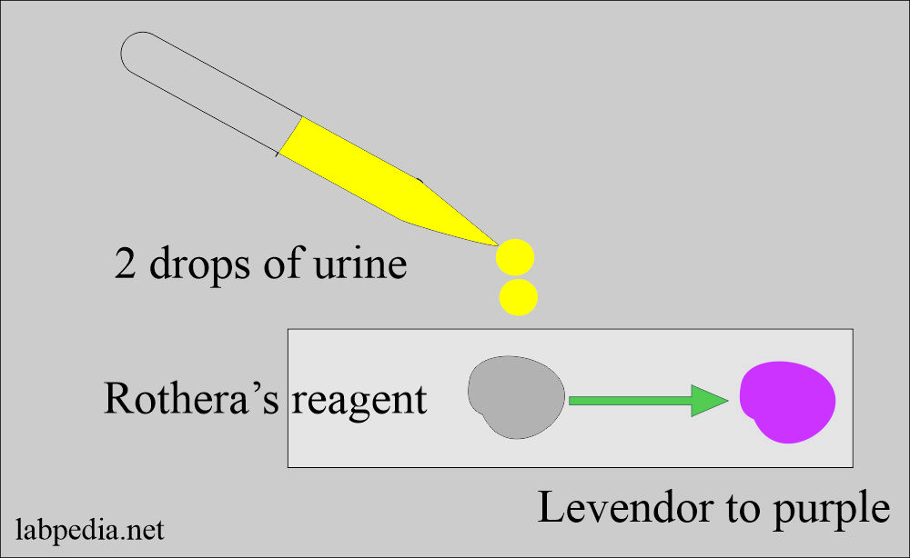 Rothera's test for ketones in the urine