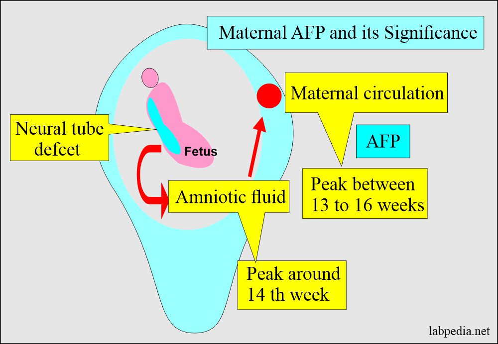 Neural tube defect and role of estimation of maternal AFP