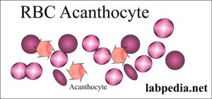 RBC acanthocyte