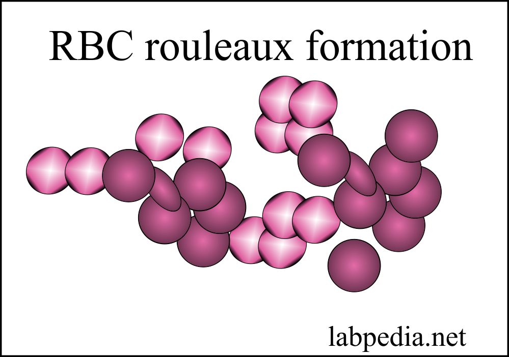 Red Blood Cell (RBC) Part 1 Peripheral blood smear, Normal Picture