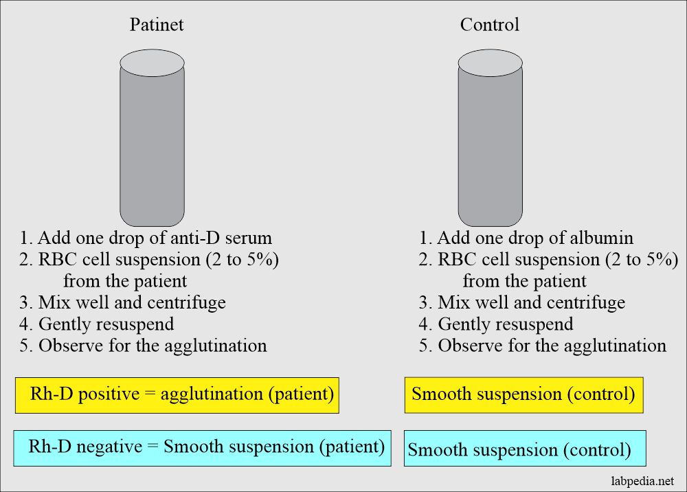 💣 Forward blood grouping principle. ABO Blood Grouping and Rh Typing