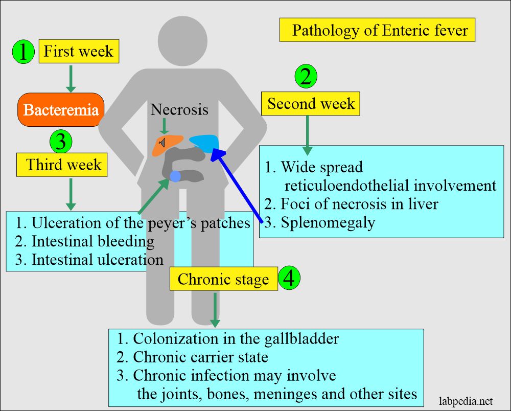Pathology of the enteric fever (S. typhi)