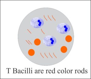 TB bacilli looks like Red Color Bacilli