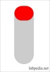 Blood Sample: – Part 3 – Types of Blood Samples, Criteria for rejection of the blood sample