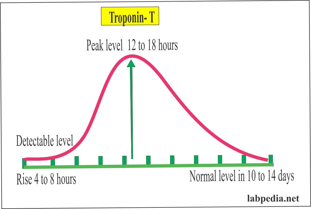 Heart Failure (Congestive heart failure ), Lab Work up