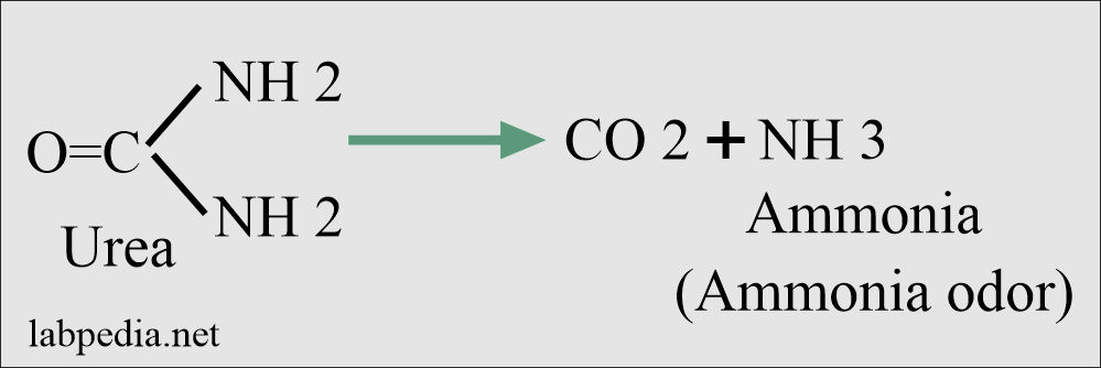 Urine Analysis: Part 3 – Complete Urine Analysis – Labpedia.net